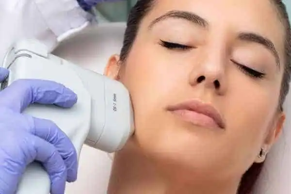 Image of woman having HIFU Braintree treatment