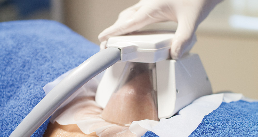 How Fat Freezing and HIFU Work Together? 2 Multiple Areas in One Session HIFU and Fat Freezing Braintree