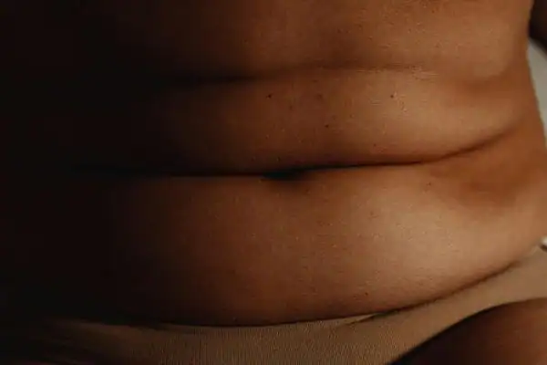The Hidden Connection: How Stress Shapes Your Fitness and Body Composition 3 image of what stress can do on the stomach area and how Lipo 360 Braintree can help to change your body shape.