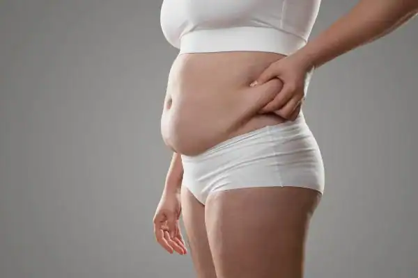 Image of stress belly Braintree How Lipo 360 can help manage your symptoms